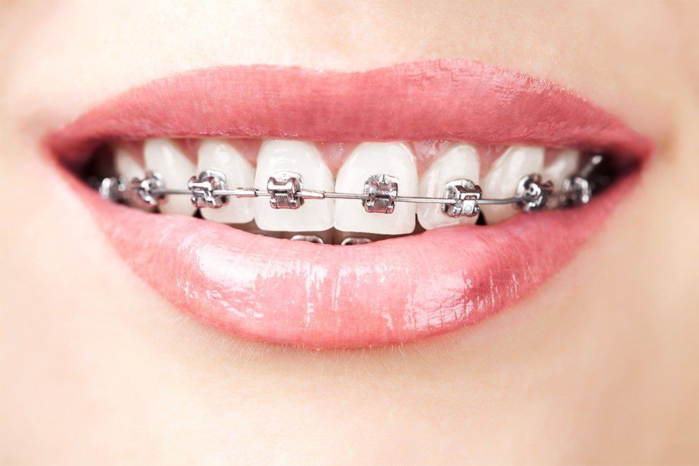 orthodontics / braces